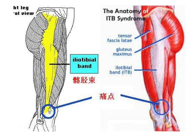 大腿韧带分布图片