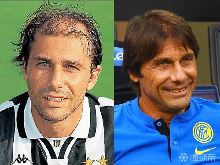 孔蒂这植发效果可以啊