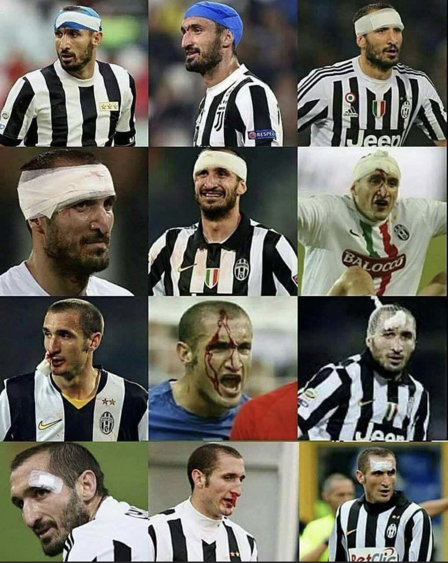 绷带狂人基耶利尼